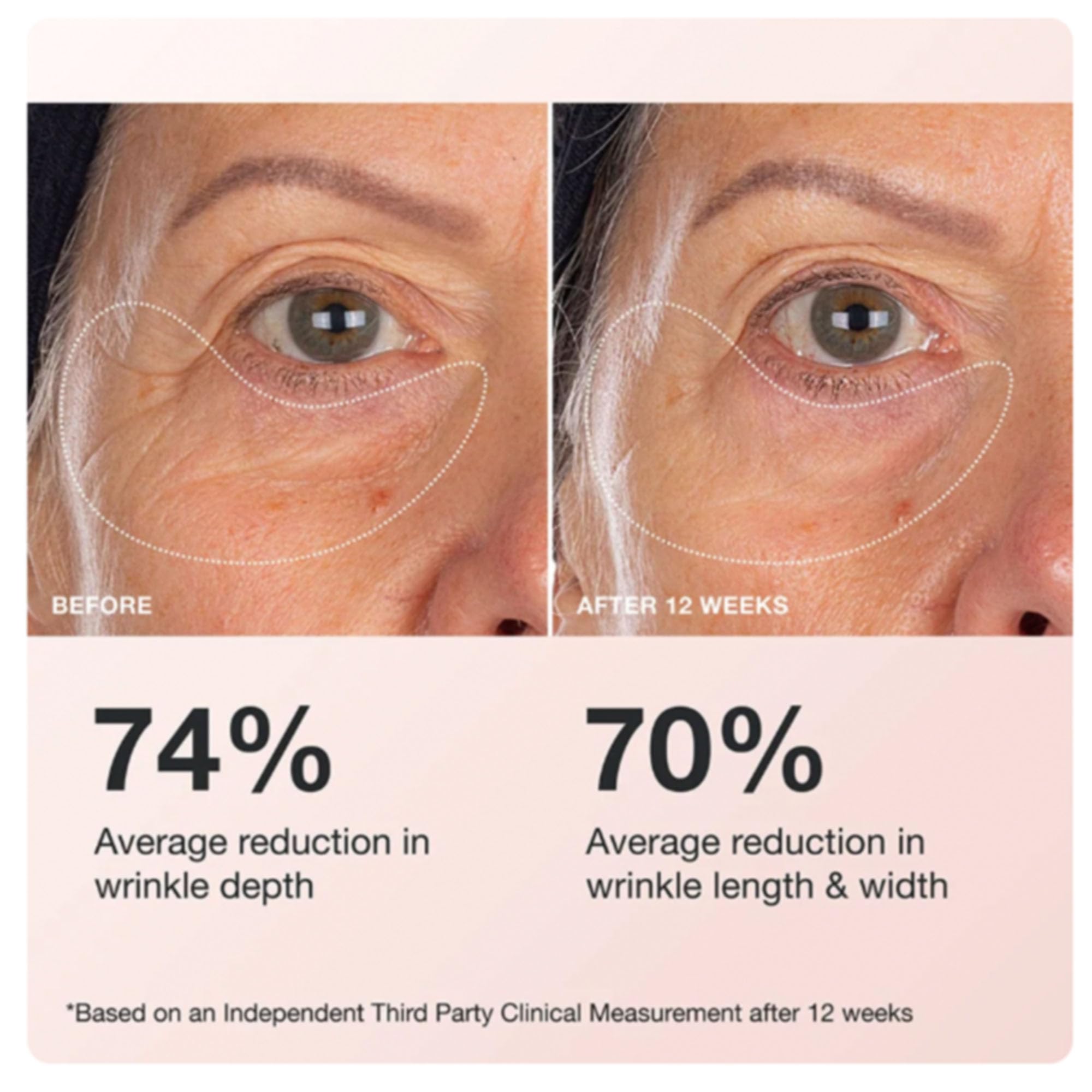 Innbeauty Project Extreme Cream Eye Firming eye-area application demonstrates how to target the orbital area.