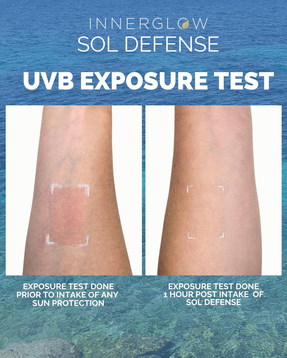 Inner Glow Sol Defense packaging and label highlighting travel-friendly design.
