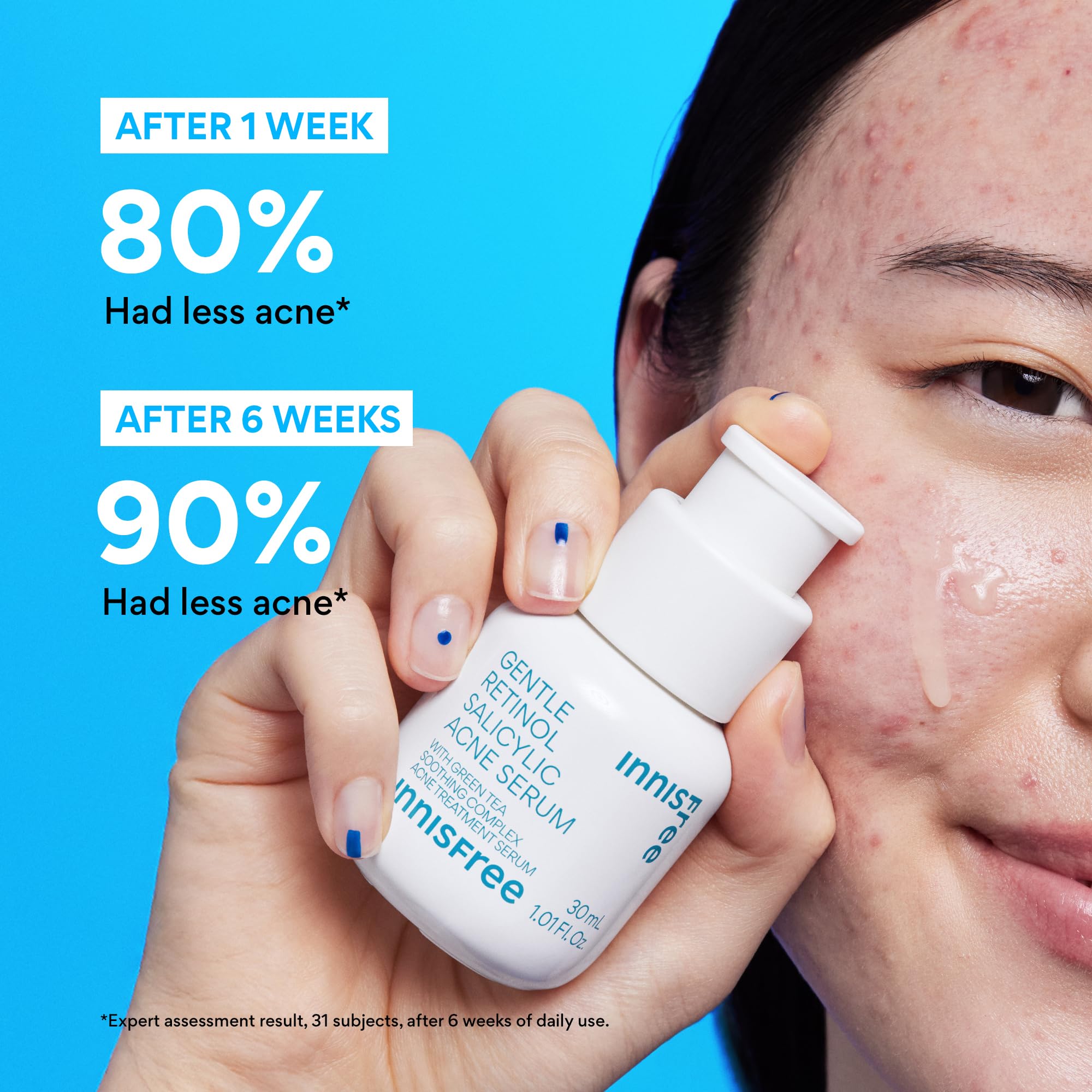Innisfree Gentle Retinol Salicylic Acne Serum packaging front for easy night and day routines.