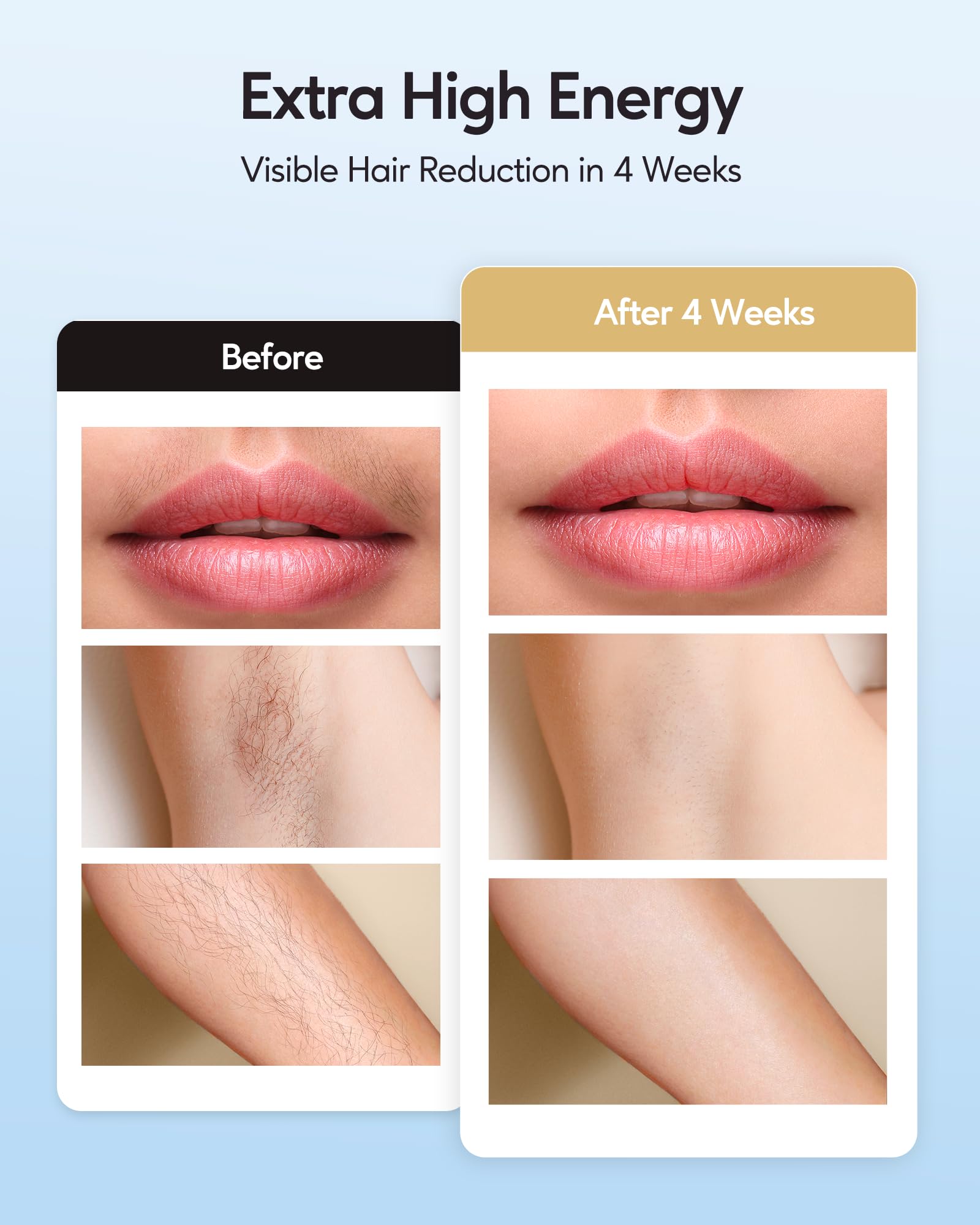 INNZA IPL manual mode for precise treatments on small areas.