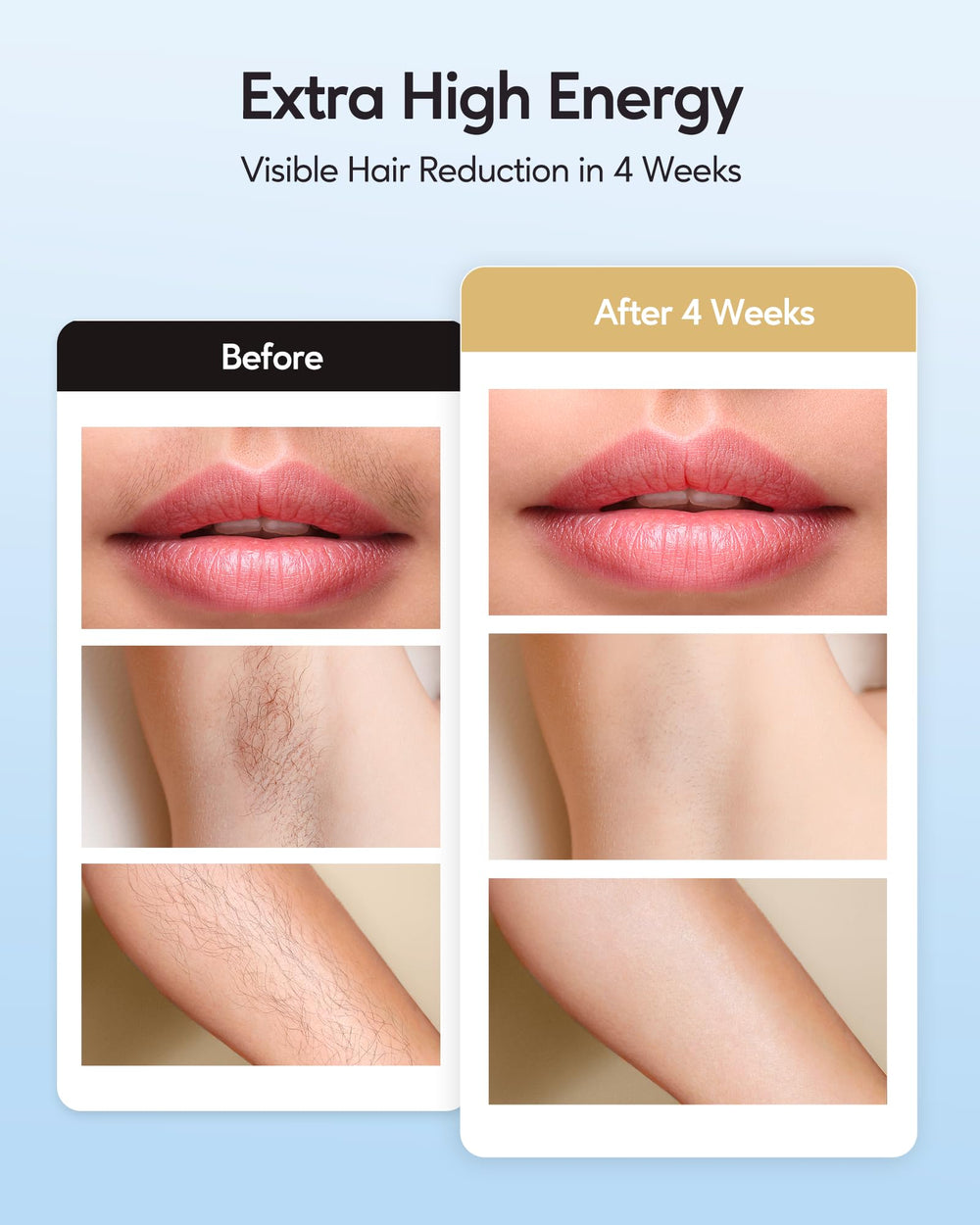 INNZA IPL manual mode for precise treatments on small areas.