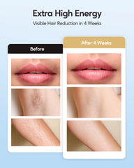 INNZA IPL manual mode for precise treatments on small areas.