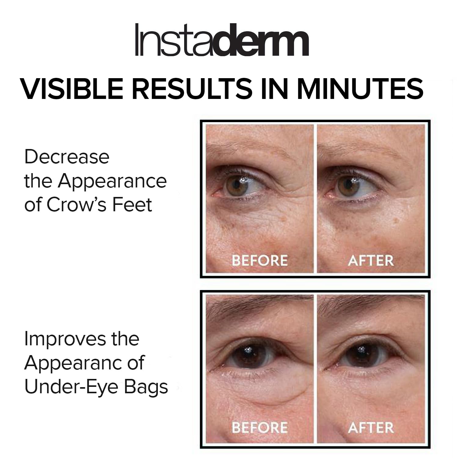 Instaderm formula with hyaluronic acid and vitamin C for hydration.