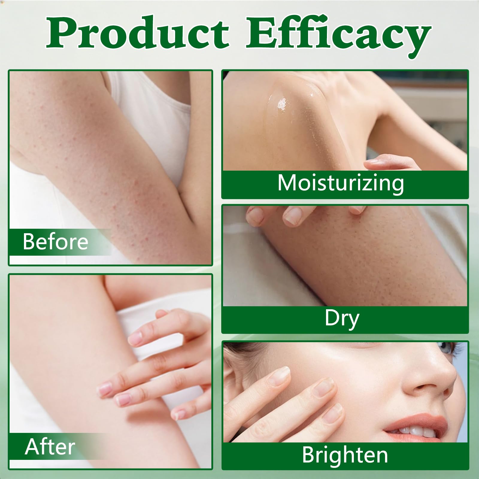 Crema Intertrigo: ideal para pliegues cutáneos y uso diario
