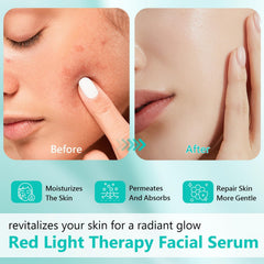 Ipsify serum activación luz roja con aplicador para uso diario