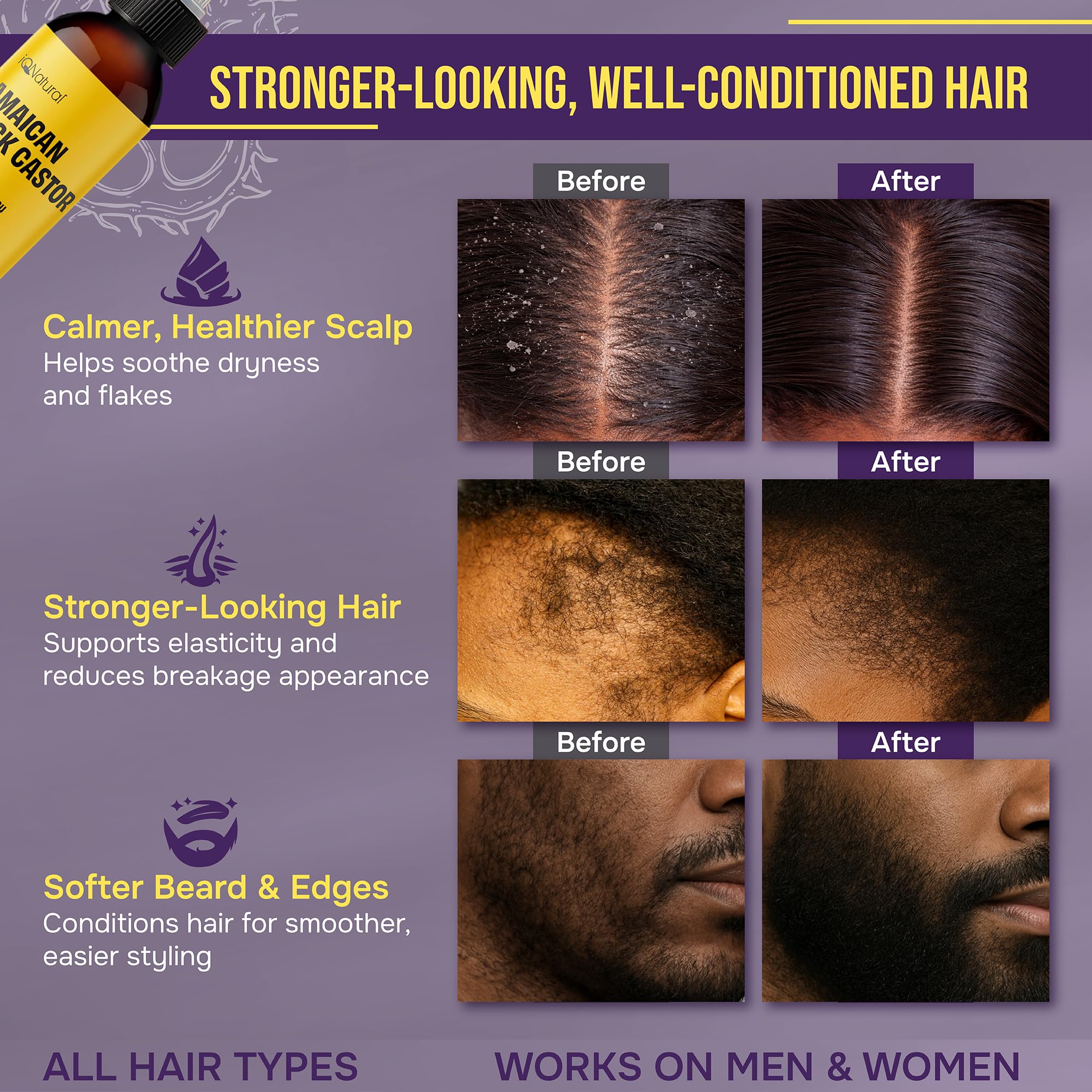IQNATURAL aplicación nocturna suave para cabello y uñas.