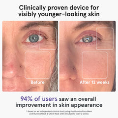 iRestore mask worn on face during relaxed treatment session