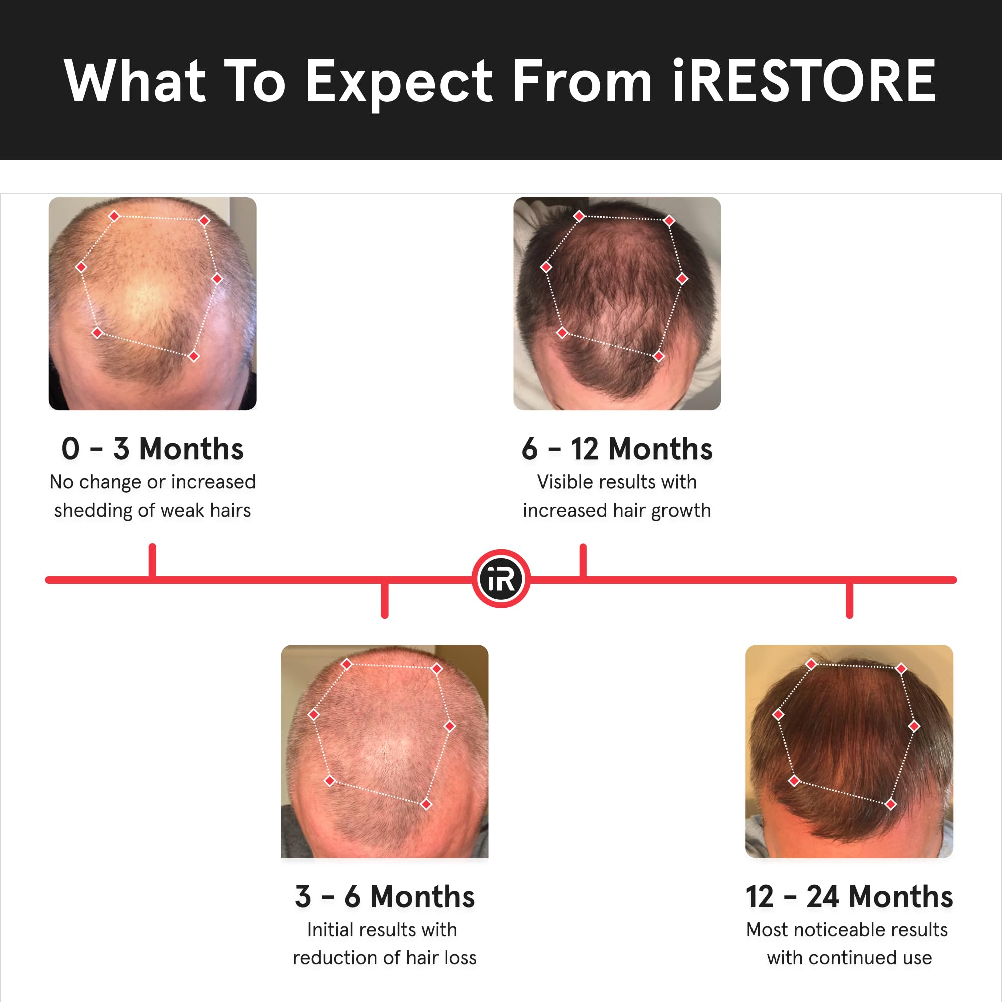 FDA-cleared label on iRestore Essential emphasizes home-use hair treatment.