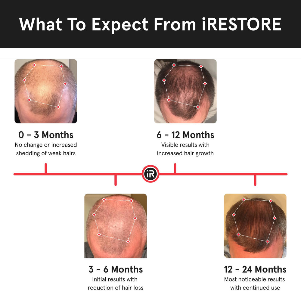 FDA-cleared label on iRestore Essential emphasizes home-use hair treatment.