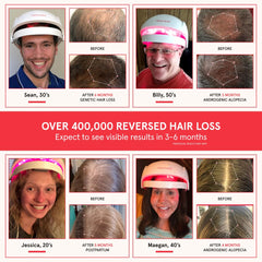 iRestore Essential worn on head for discreet at-home hair regrowth routine.