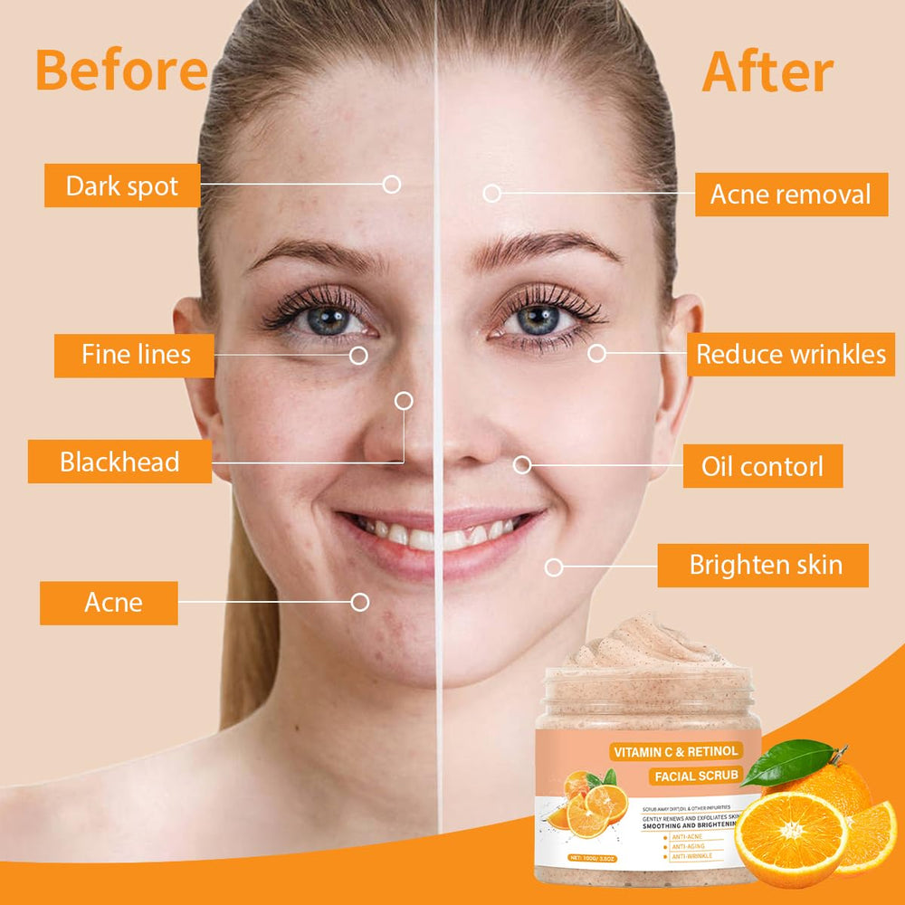 IREV Exfoliante con retinol para rostro, suaviza líneas y desobstruye poros.