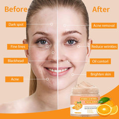 IREV Exfoliante con retinol para rostro, suaviza líneas y desobstruye poros.