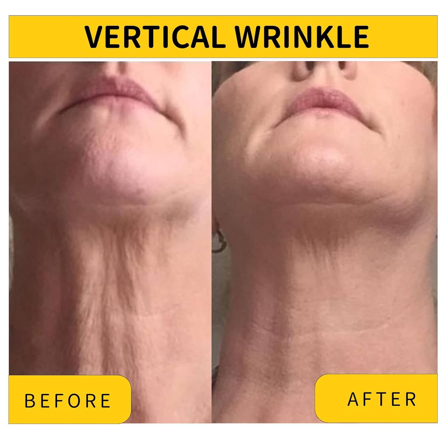 Irismistx crema cuello, contorno más firme para cuello y escote