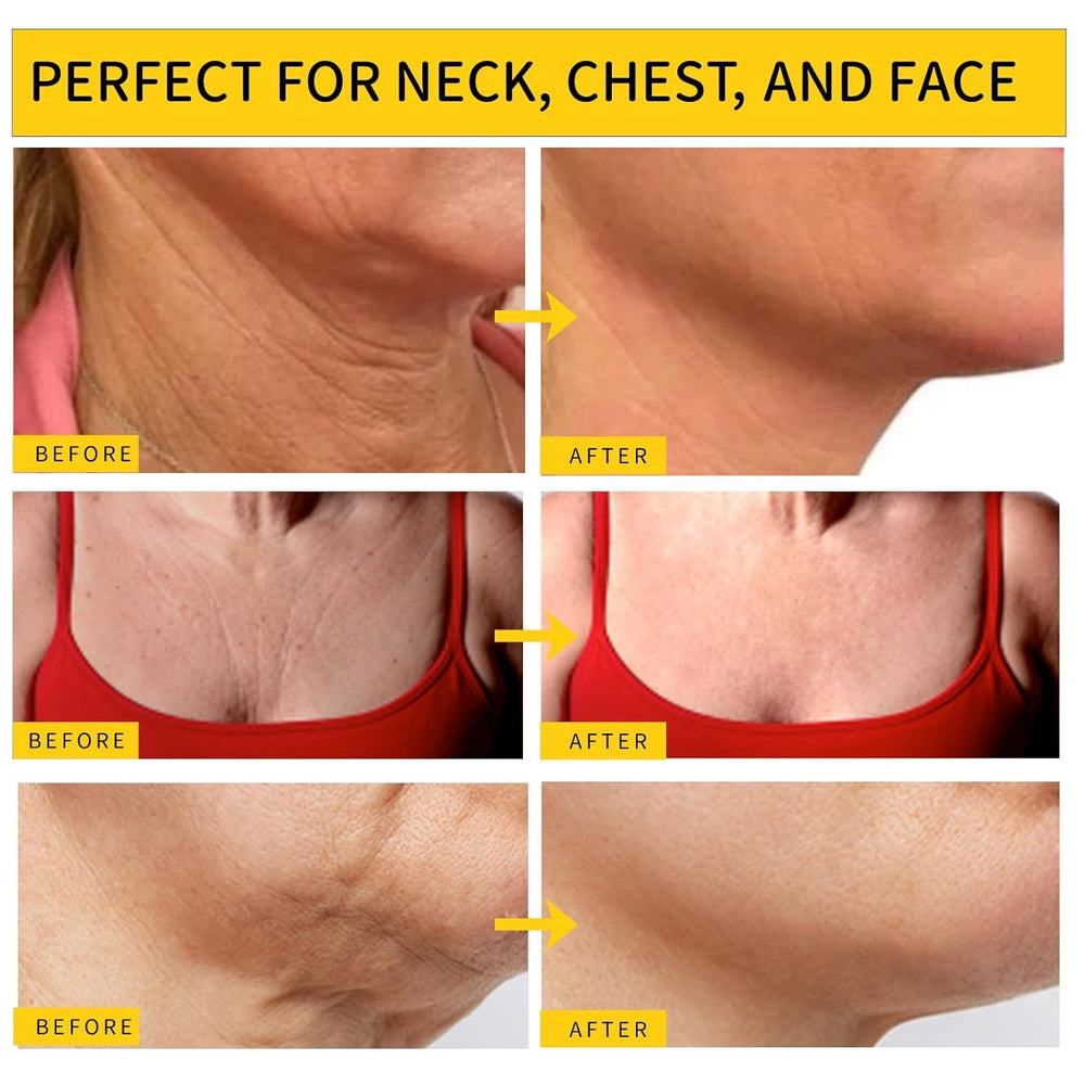 Irismistx crema cuello, hidratación profunda para lograr piel suave