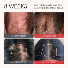 iRestore Biotin Hair Conditioner label close-up highlights premium ingredients.