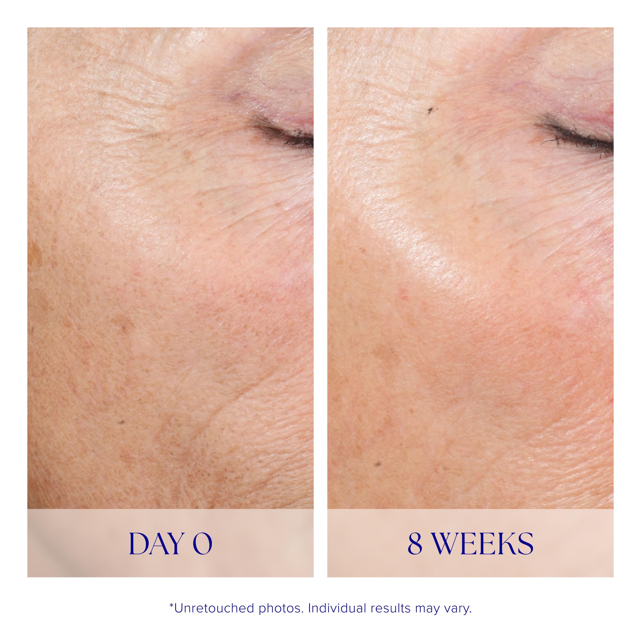 iS CLINICAL Active Peel System at-home routine closeup, simple two-step treatment