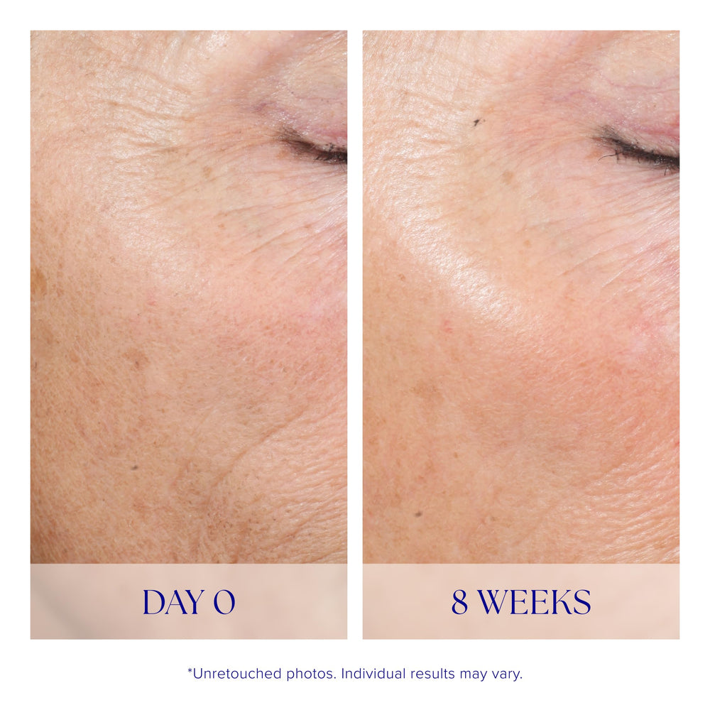 iS CLINICAL Active Peel System at-home routine closeup, simple two-step treatment