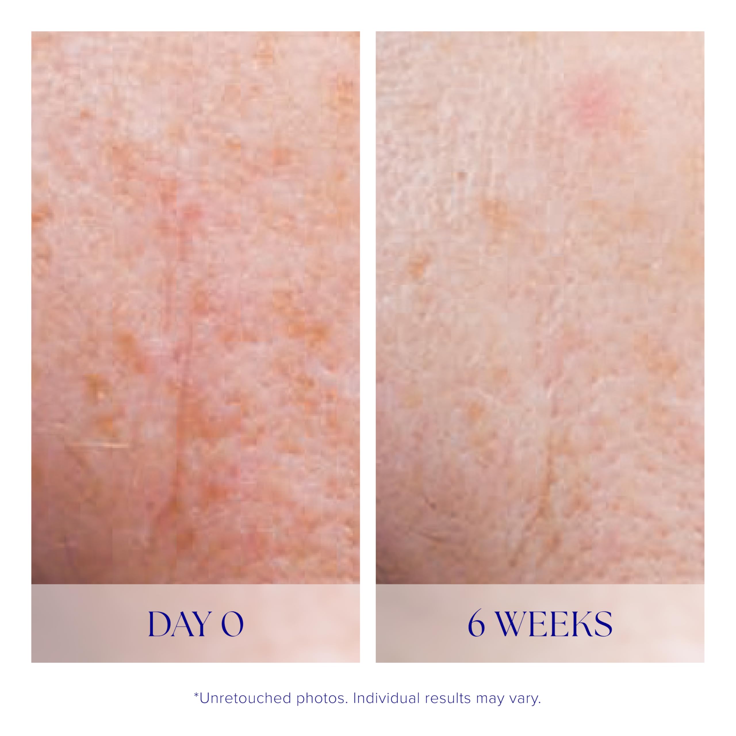 iS CLINICAL Active Serum on mirror setup demonstrates versatile usage