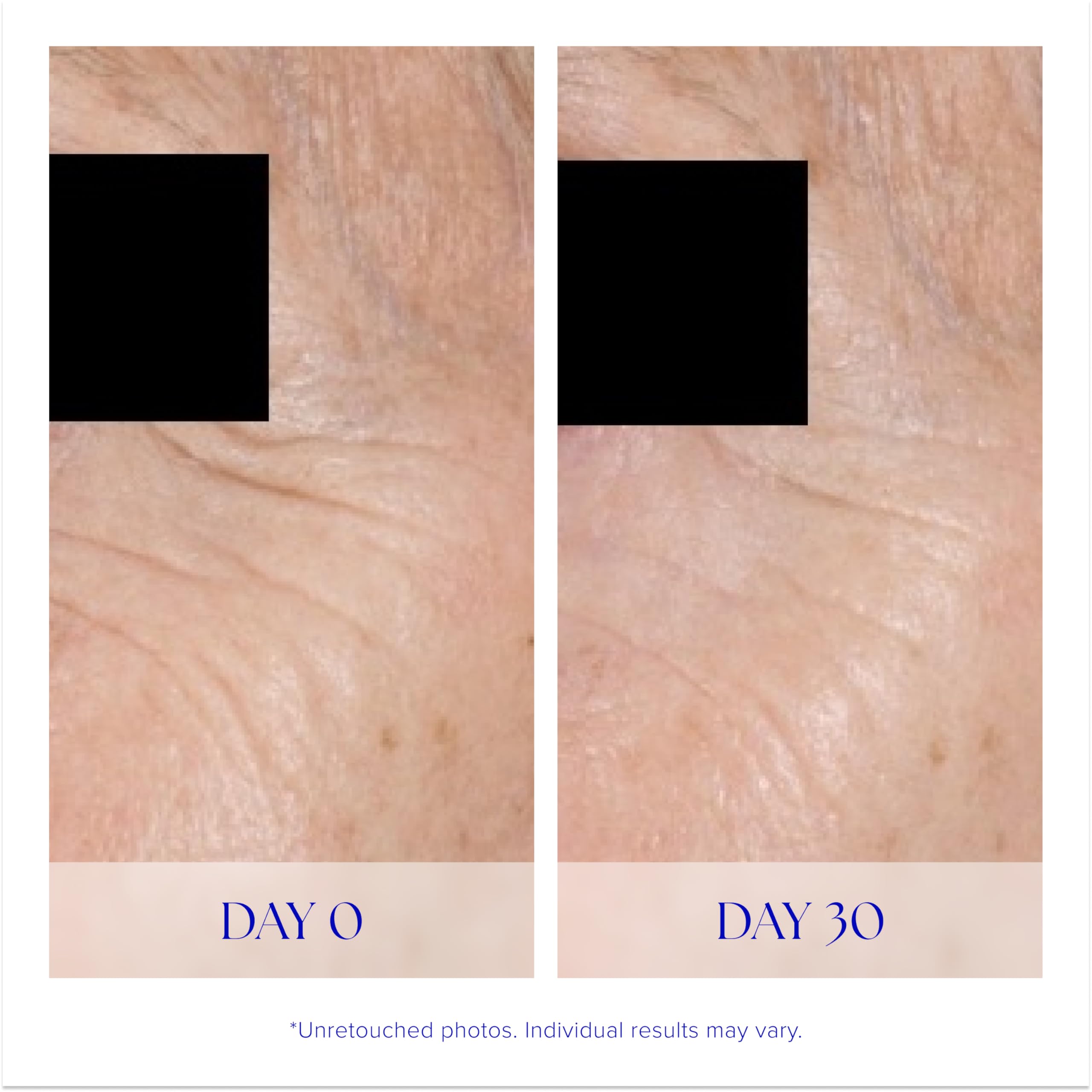 iS CLINICAL Youth Eye Complex applied to delicate under-eye area with gentle touch.