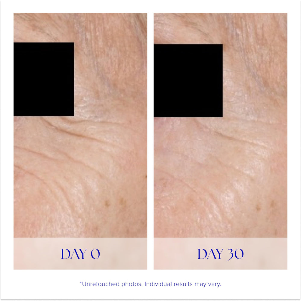 iS CLINICAL Youth Eye Complex applied to delicate under-eye area with gentle touch.