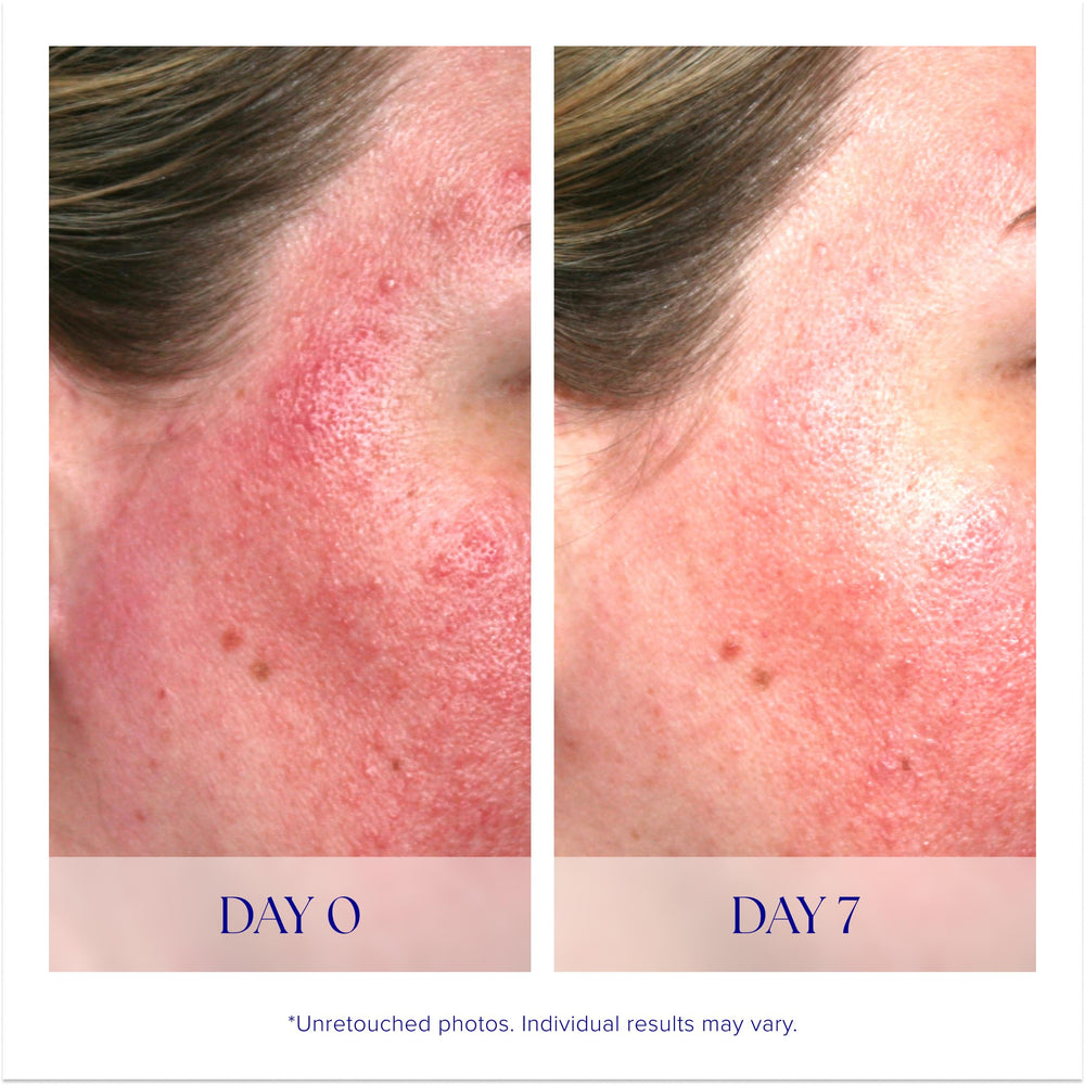 iS Clinical Pro-Heal Serum Advance+ packaging shown as travel-friendly bottle