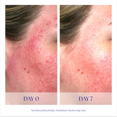 iS Clinical Pro-Heal Serum Advance+ packaging shown as travel-friendly bottle