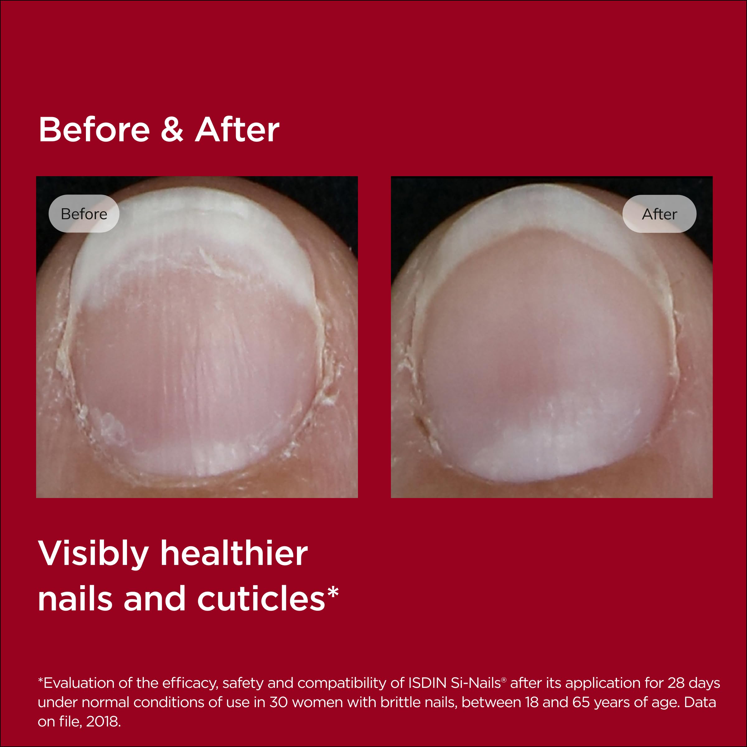 ISDIN Si-Nails hydration boost emphasizes nourished, less dry nails after use.