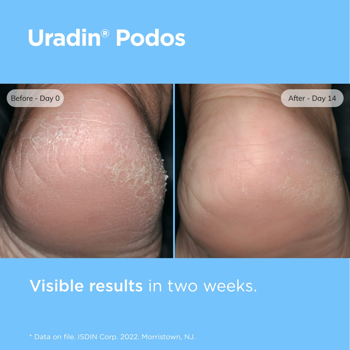 ISDIN Uradin Podos Gel Oil packaging demonstrates easy dispensing and mess-free use.