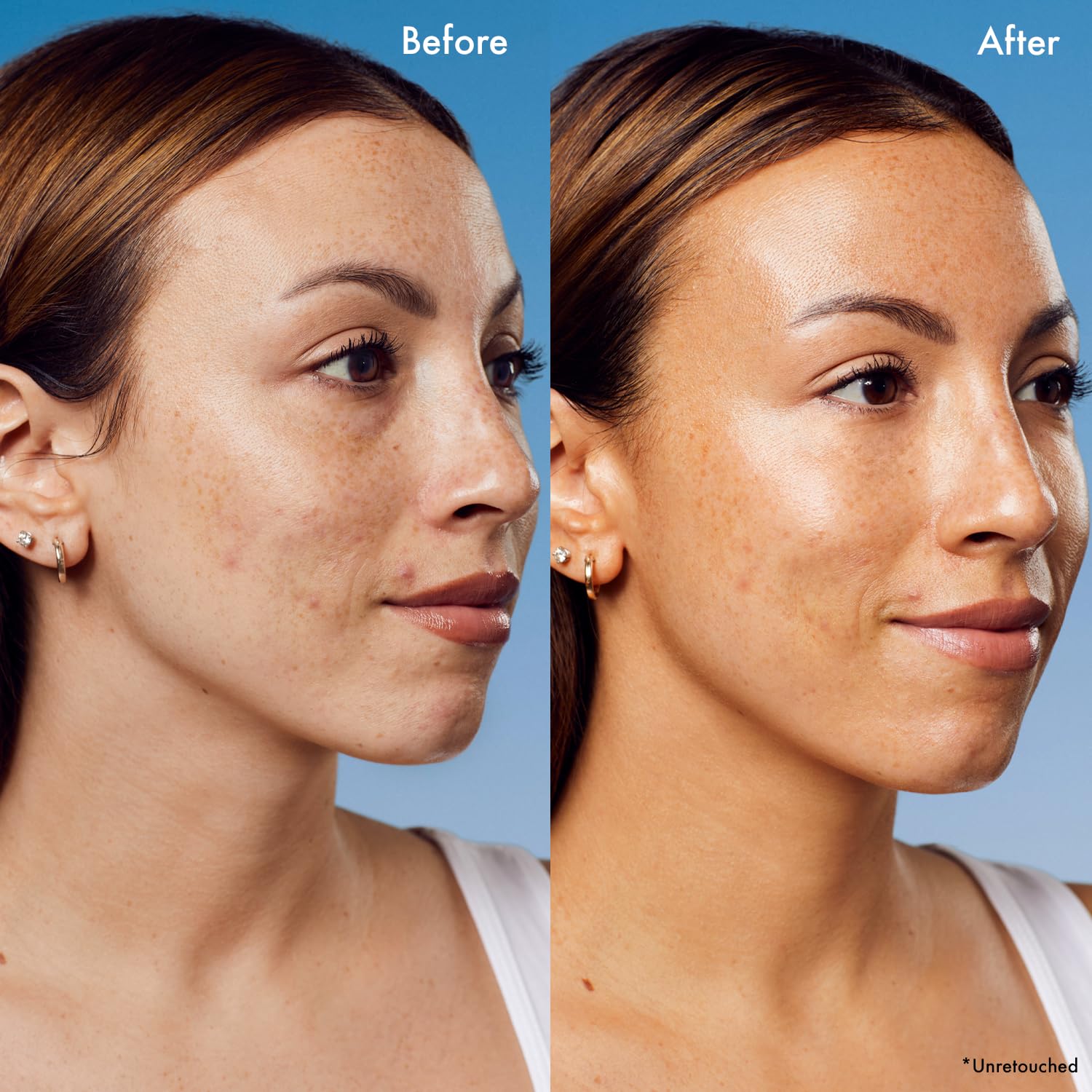 Dermatologist-approved and fragrance-free formula for sensitive skin