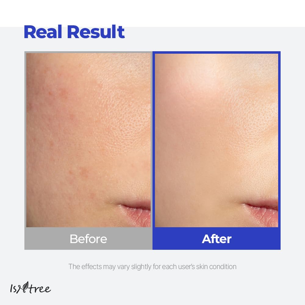 IsNtree crema gel de ácido hialurónico con ingredientes naturales para piel equilibrada.