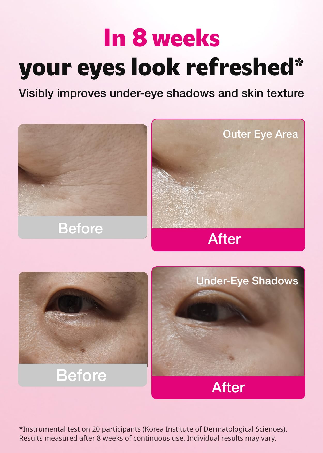 ISOI parches oculares, tono y suavidad mejorados alrededor de los ojos
