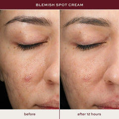 Textura suave del tratamiento ITK Skincare en la piel.