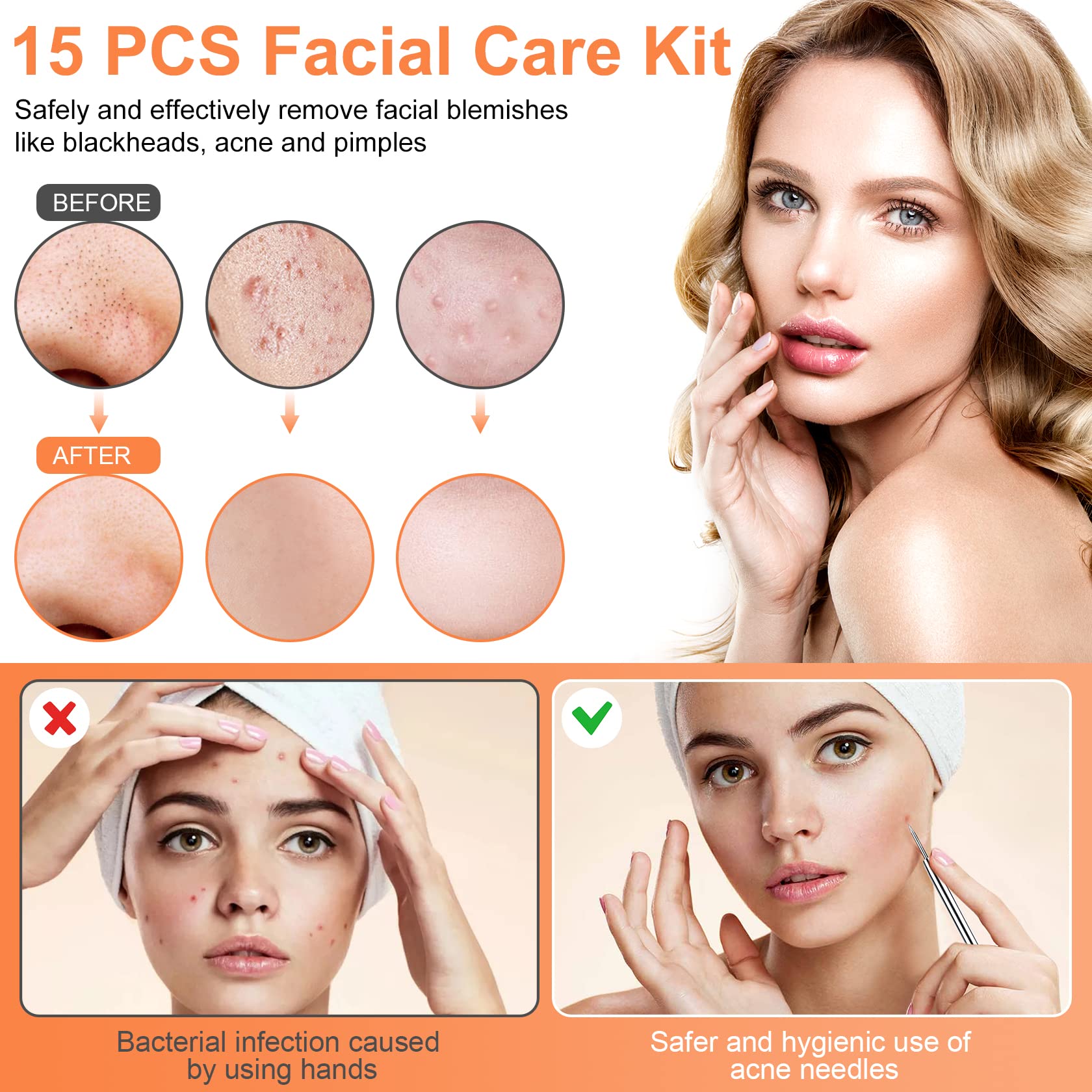 IUMAKEVP blackhead remover tools set for quick, clean blemish handling.
