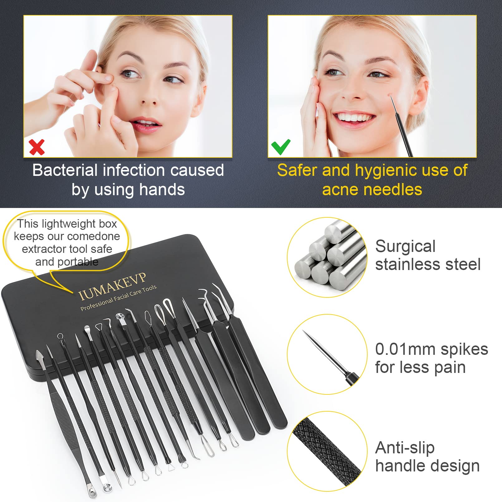 IUMAKEVP comedone extractor and tweezers for targeted removal