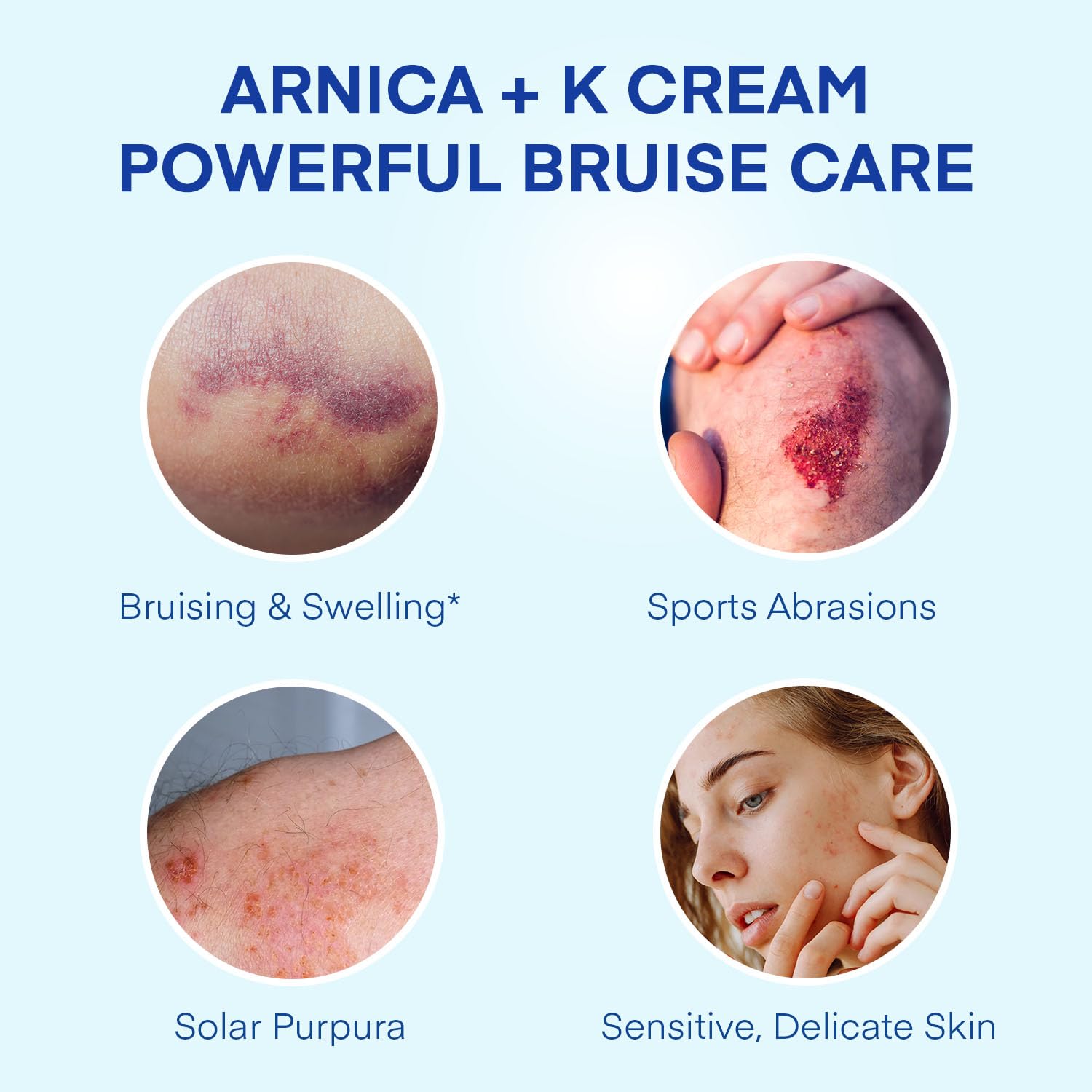 Jardient Arnica Bruise Cream face application demonstrates gentle care for thin skin areas