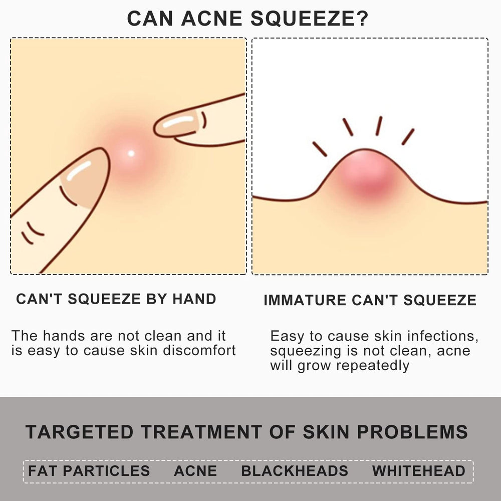 Jaxiria 2-in-1 acne extractor ends in use, puncture and squeeze.