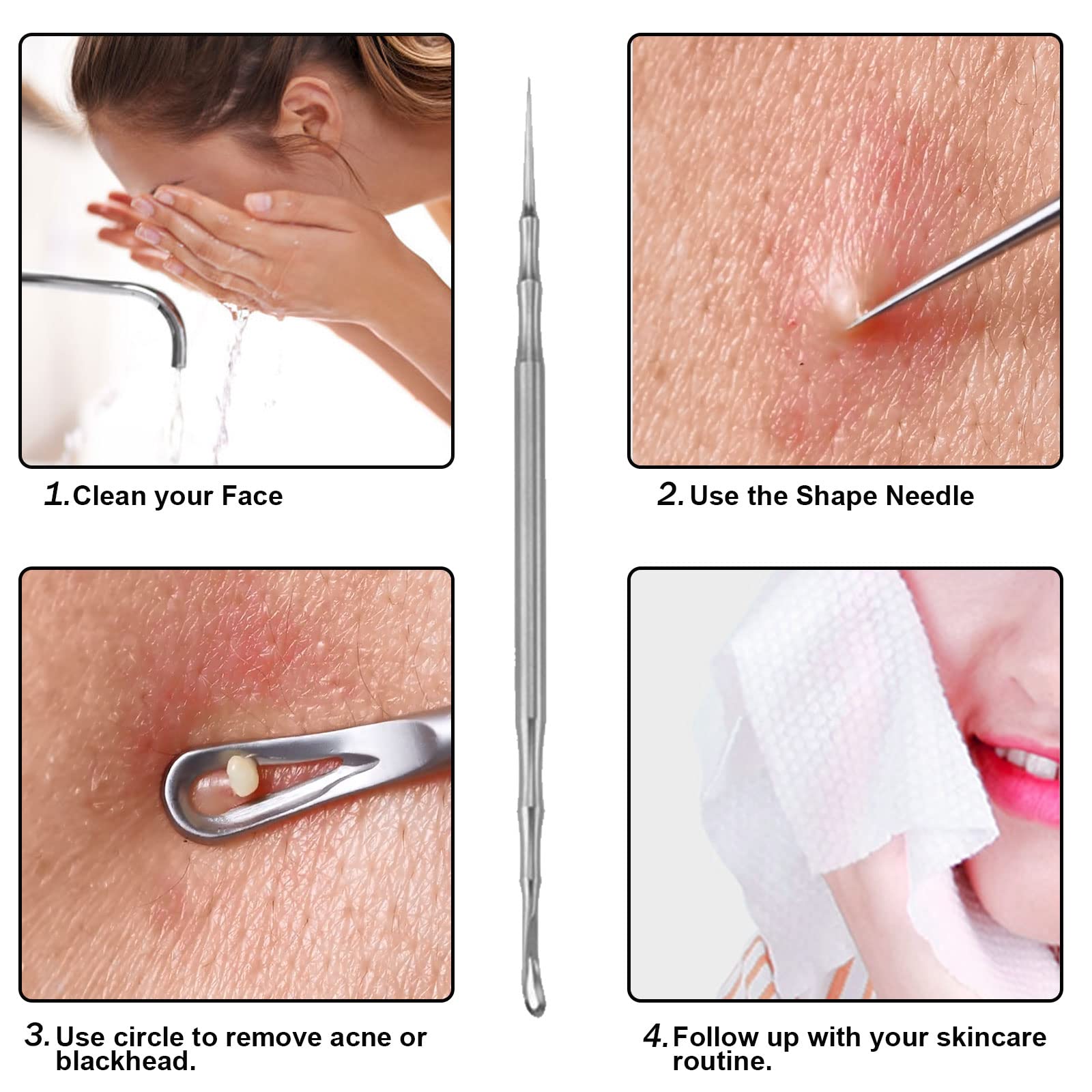 Jaxiria acne extractor round case image emphasizes portability and hygiene.