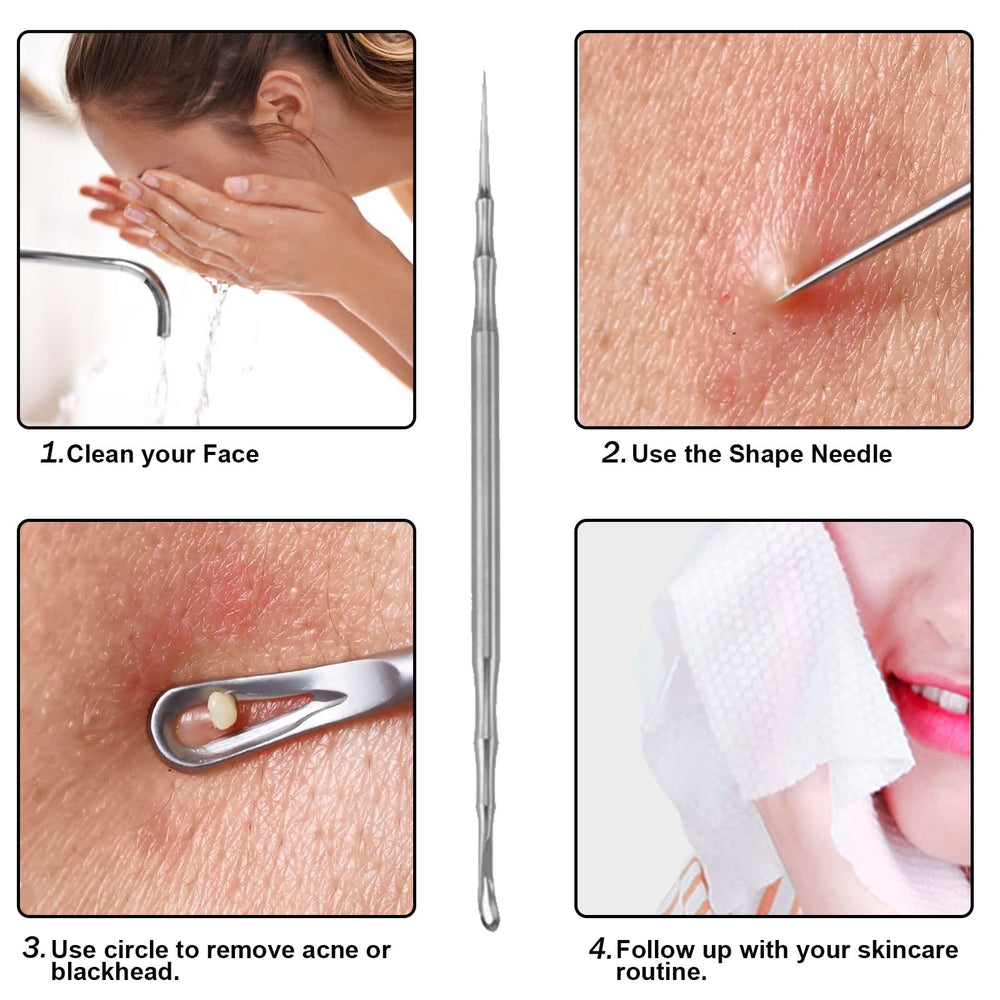 Jaxiria acne extractor round case image emphasizes portability and hygiene.