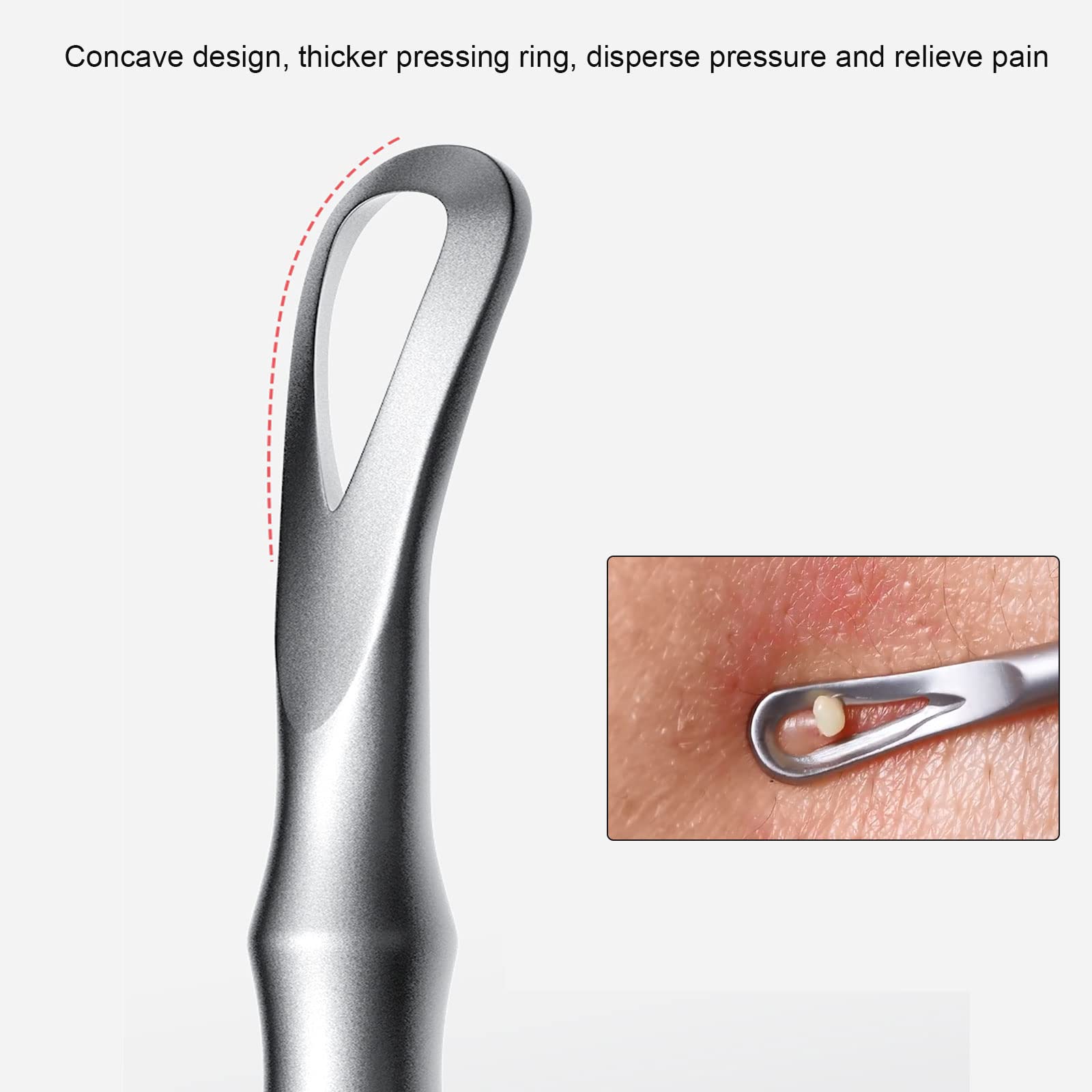Jaxiria stainless steel acne extractor closeup highlights durable, rust-resistant construction.