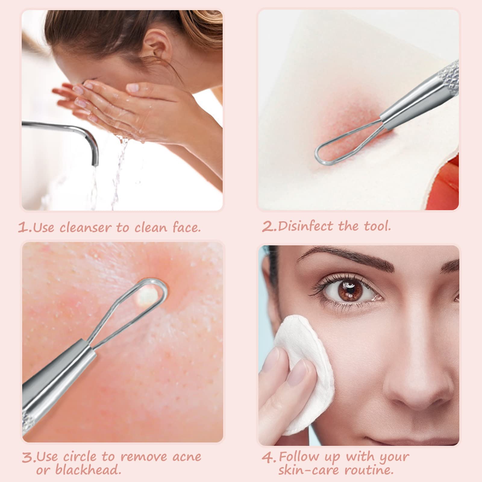 jaxiria stainless steel pimple popper closeup highlighting durable handle