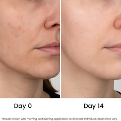 Jeune Naturelle brightening application demonstrates glow-friendly results for daily use.