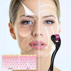 JonhTech derma roller for scalp to support hair and scalp care