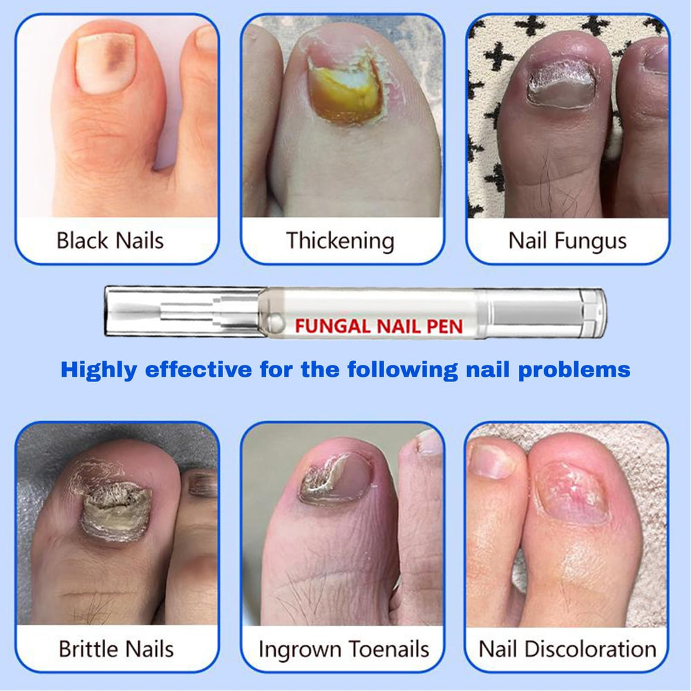 JONKEYPENY mejora el brillo natural de las uñas