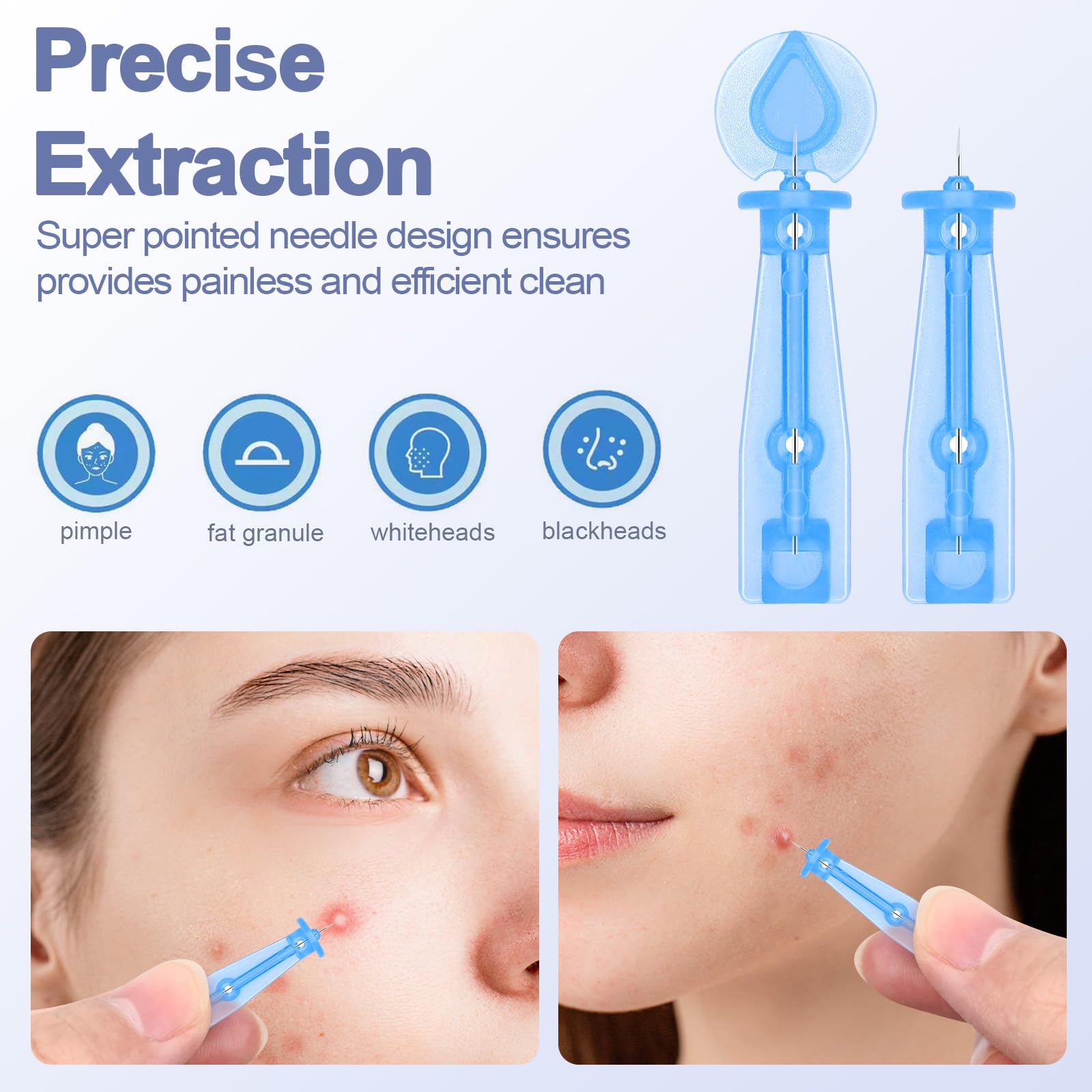 Jozaya twist-cap needle design enables controlled pimple extraction
