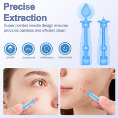 Jozaya twist-cap needle design enables controlled pimple extraction