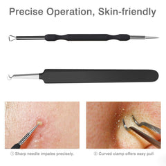 JPNK Pimple Extractor with ergonomic anti-slip grip for precise, safe use.