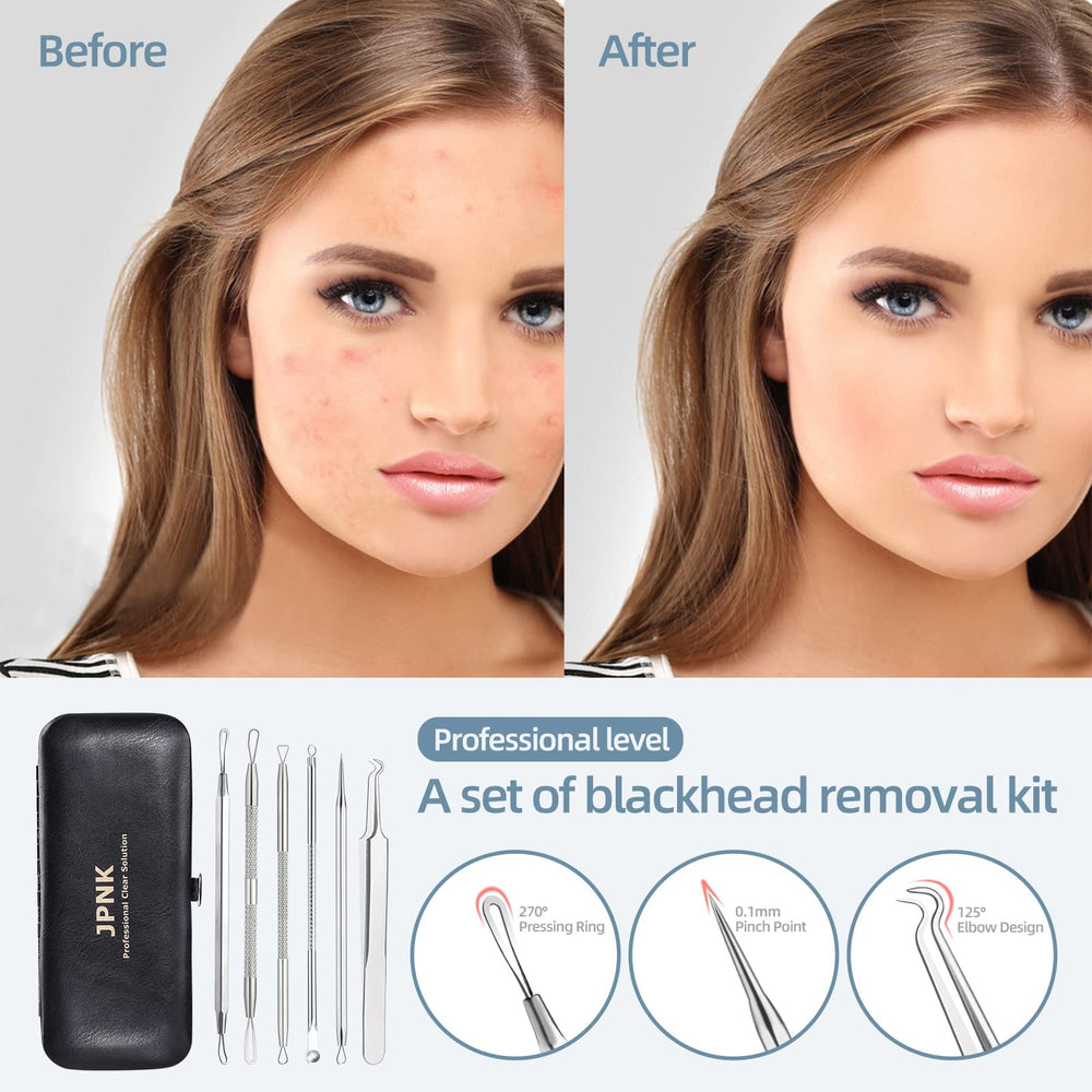JPNK stainless steel pimple extractor showing durable, rust-resistant design