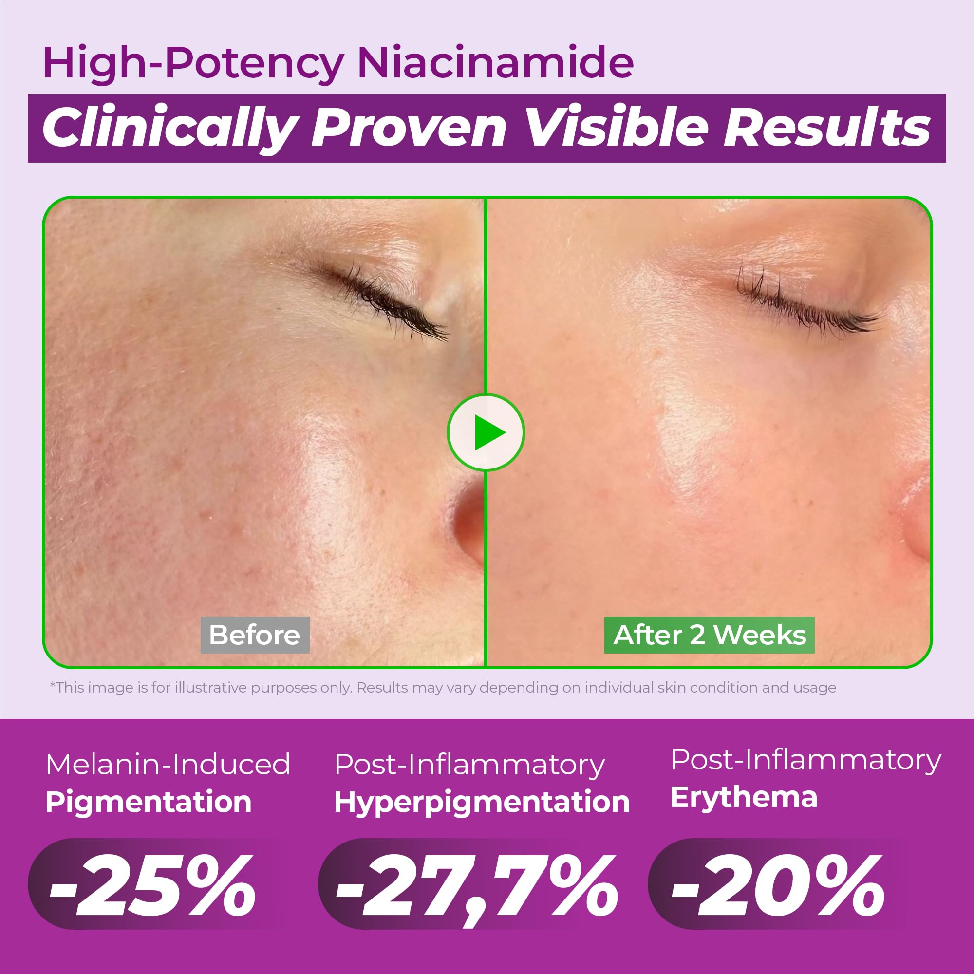 Illustration of the ingredient trio: niacinamide, TXA, and glutathione