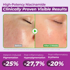Illustration of the ingredient trio: niacinamide, TXA, and glutathione