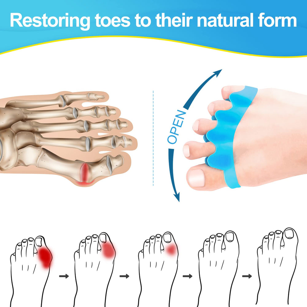 Juzure toe correctors worn under socks for bunion alignment support.